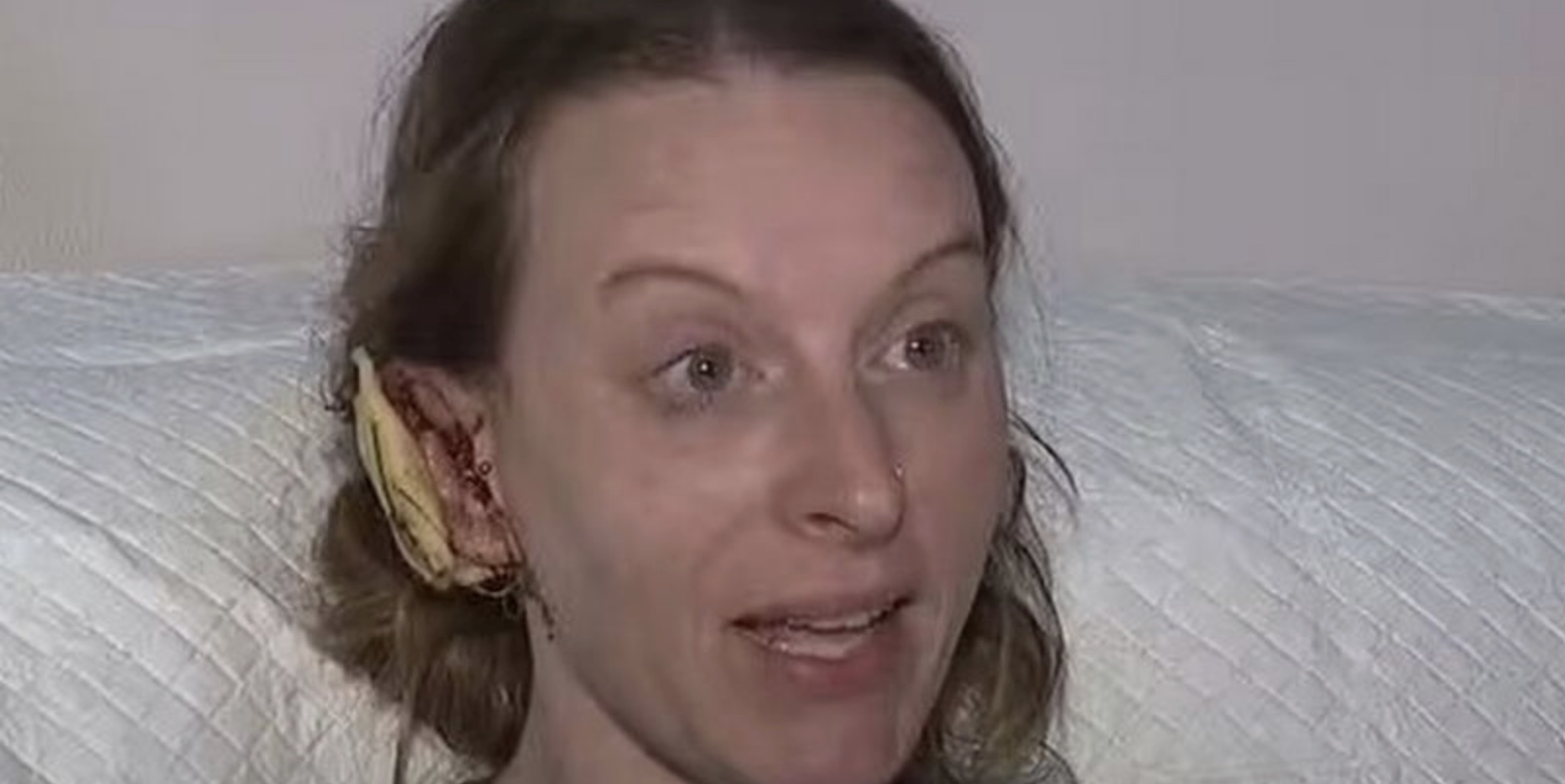 Woman's Ear Ripped Off by Pet Monkey in Oklahoma Attack