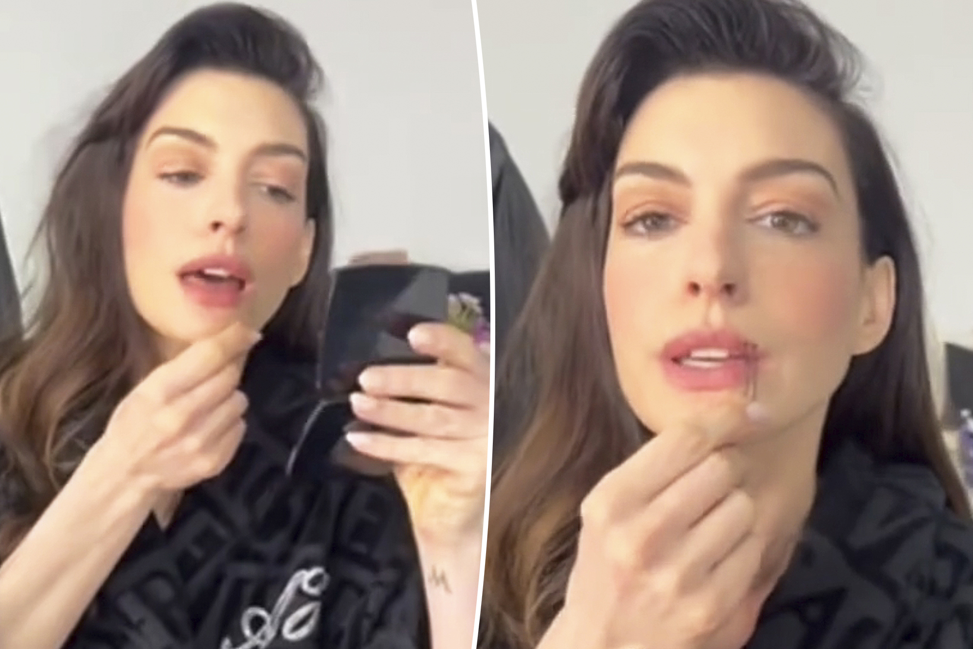 Anne Hathaway's Surprising Lip-Plumping Trick Goes Viral on TikTok!