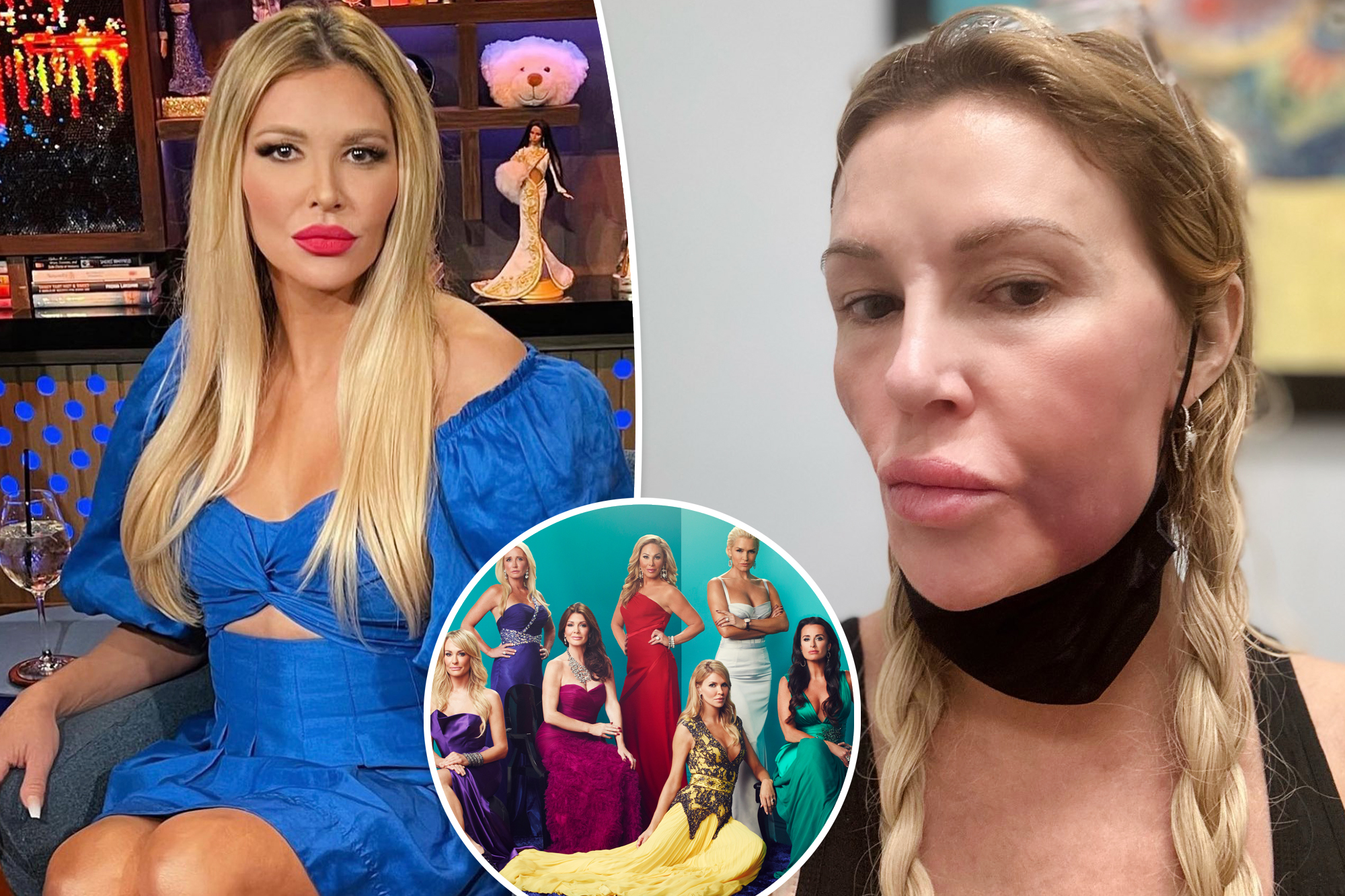 Brandi Glanville's Shocking Facial Transformation: The Real Story Behind Her Swollen Face