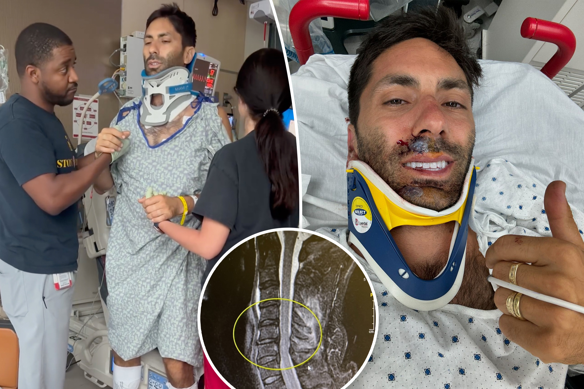 Nev Schulman's Miraculous Recovery: How a Bike Accident Changed His Perspective on Life